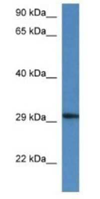 Western Blot: HARBI1 Antibody [NBP1-74230] - Mouse Kidney Lysate 1ug/ml  Gel Concentration 12%