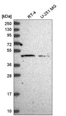 Western Blot HARBI1 Antibody - BSA Free