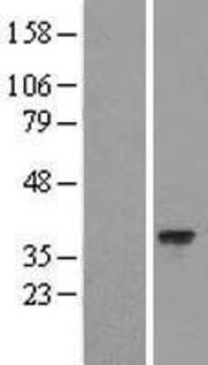 Western Blot: HARBI1 Overexpression Lysate (Adult Normal) [NBL1-11447] Left-Empty vector transfected control cell lysate (HEK293 cell lysate); Right -Over-expression Lysate for HARBI1.