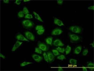 Immunocytochemistry/Immunofluorescence: HARS Antibody (1C8) [H00003035-M01] - Analysis of monoclonal antibody to HARS on HeLa cell. Antibody concentration 10 ug/ml.