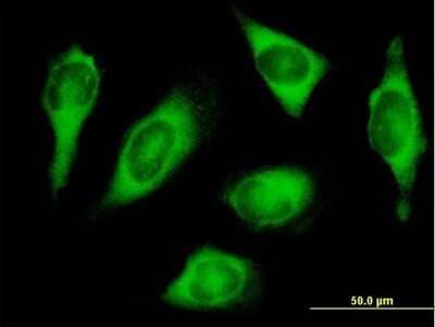 Immunocytochemistry/Immunofluorescence: HARS Antibody [H00003035-B01P] - Analysis of purified antibody to HARS on HeLa cell. (antibody concentration 10 ug/ml)