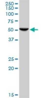 Western Blot: HARS Antibody [H00003035-B01P] - Analysis of HARS expression in HeLa.