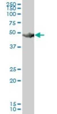 Western Blot HARS Antibody