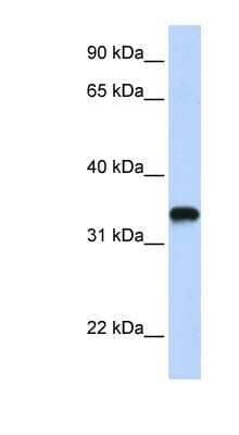 Western Blot: HAS3 Antibody [NBP1-62552] - Transfected 293T cell lysate, concentration 0.2-1 ug/ml.