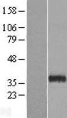 Western Blot: HAS3 Overexpression Lysate (Adult Normal) [NBL1-11450] Left-Empty vector transfected control cell lysate (HEK293 cell lysate); Right -Over-expression Lysate for HAS3.