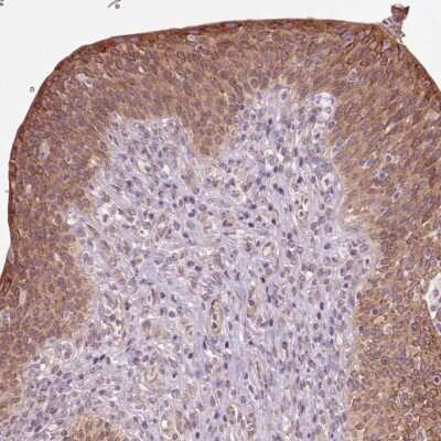 Immunohistochemistry-Paraffin: HAUS5 Antibody [NBP2-38104] - Staining of human urinary bladder shows moderate cytoplasmic positivity in urothelial cells.
