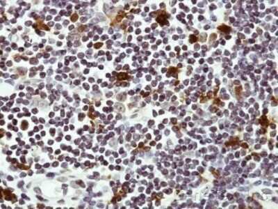 Immunohistochemistry-Paraffin HAUS8 Antibody