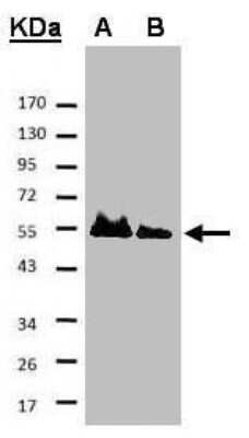 Western Blot HAUS8 Antibody