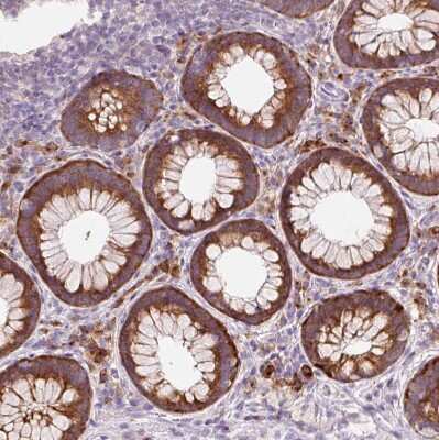 Immunohistochemistry-Paraffin: HAX-1 Antibody [NBP2-49169] - Staining of human rectum shows moderate to strong granular cytoplasmic positivity in glandular cells and a subset of leukocytes.