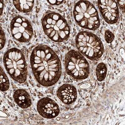 Immunohistochemistry-Paraffin HBLD1 Antibody