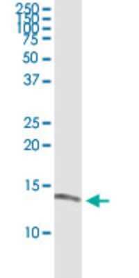 Western Blot HBLD2 Antibody (1A11) - Azide and BSA Free