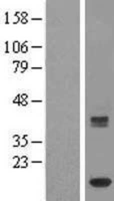 Western Blot: HBLD2 Overexpression Lysate (Adult Normal) [NBL1-12043] Left-Empty vector transfected control cell lysate (HEK293 cell lysate); Right -Over-expression Lysate for HBLD2.
