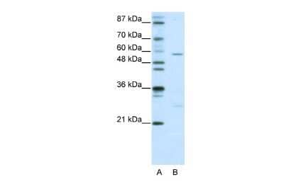 Western Blot: HBP1 Antibody [NBP3-10491] - Western blot analysis using NBP3-10491 on Human Jurkat as a positive control. Antibody Titration: 0.2-1 ug/ml