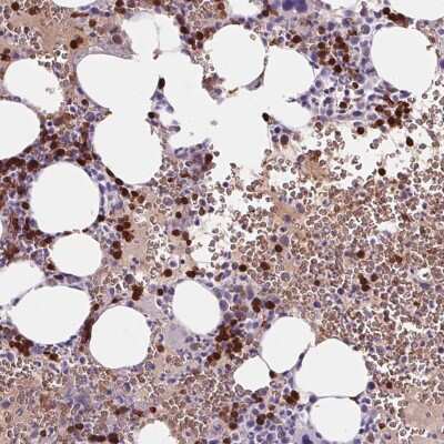 Immunohistochemistry-Paraffin: HBQ1 Antibody [NBP2-38960] - Staining of human bone marrow shows high expression.