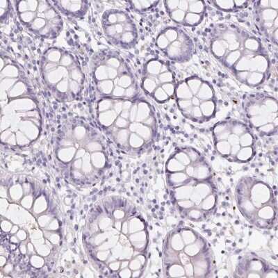 Immunohistochemistry-Paraffin: HBQ1 Antibody [NBP2-38960] - Staining of human colon shows low expression as expected.