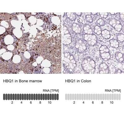 <b>Orthogonal Strategies Validation. </b>Immunohistochemistry-Paraffin: HBQ1 Antibody [NBP2-38960] - Staining in human bone marrow and colon tissues using anti-HBQ1 antibody. Corresponding HBQ1 RNA-seq data are presented for the same tissues.