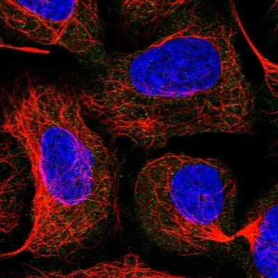 Immunocytochemistry/Immunofluorescence: HBS1L Antibody [NBP1-85124] - Immunofluorescent staining of human cell line U-2 OS shows localization to cytosol.