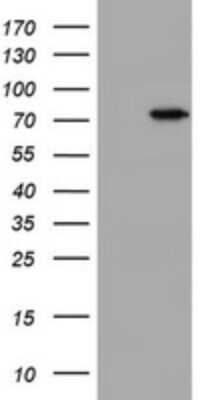 Western Blot: HBS1L Antibody (OTI1C1) - Azide and BSA Free [NBP2-71628] - Analysis of HEK293T cells were transfected with the pCMV6-ENTRY control (Left lane) or pCMV6-ENTRY HBS1L.