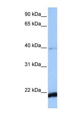 Western Blot HBS1L Antibody