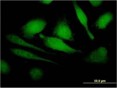 Immunocytochemistry/Immunofluorescence: HBXIP Antibody (4G1) [H00010542-M12] - Analysis of monoclonal antibody to HBXIP on HeLa cell. Antibody concentration 10 ug/ml