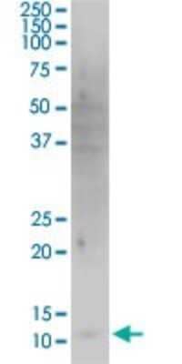 Western Blot: HBXIP Antibody (4G1) [H00010542-M12] - Analysis of HBXIP expression in A-431.