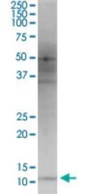 Western Blot: HBXIP Antibody (4G1) [H00010542-M12] - Analysis of HBXIP expression in Jurkat.