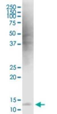 Western Blot: HBXIP Antibody (4G1) [H00010542-M12] - Analysis of HBXIP expression in MCF-7.