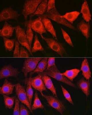 Immunocytochemistry/Immunofluorescence: HBXIP Antibody [NBP3-03300] - Immunofluorescence analysis of NIH/3T3 cells using HBXIP Rabbit pAb (NBP3-03300) at dilution of 1:200 (40x lens). Blue: DAPI for nuclear staining.