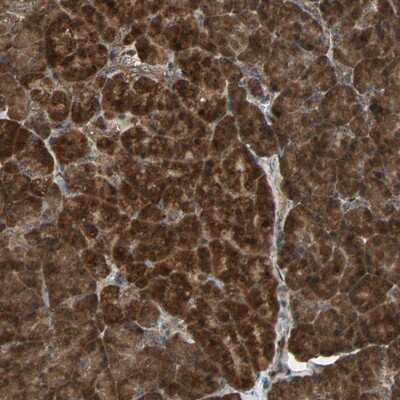 Immunohistochemistry-Paraffin: HBXIP Antibody [NBP1-82664] - Staining of human pancreas shows strong cytoplasmic positivity in exocrine glandular cells.