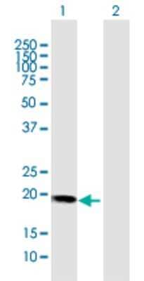Western Blot: HBXIP Antibody [H00010542-D02P] - Analysis of HBXIP expression in transfected 293T cell line by HBXIP polyclonal antibody.Lane 1: HBXIP transfected lysate(18.20 KDa).Lane 2: Non-transfected lysate.