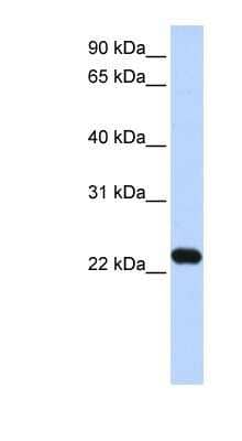 Western Blot: HBXIP Antibody [NBP1-53103] - Transfected 293T cell lysate, concentration 0.2-1 ug/ml.