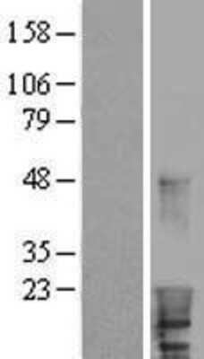 Western Blot: HBXIP Overexpression Lysate (Adult Normal) [NBL1-11465] Left-Empty vector transfected control cell lysate (HEK293 cell lysate); Right -Over-expression Lysate for HBXIP.