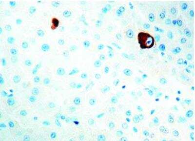 Immunohistochemistry-Paraffin: HBsAg Antibody (3E7) [NBP1-22568] - Human liver.