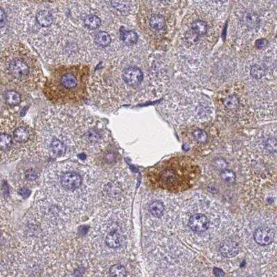 Immunohistochemistry-Paraffin: HBsAg Antibody (3E7) [NBP1-22568] - Staining in mouse liver, 1:50 antibody dilution, image from a verified customer review.
