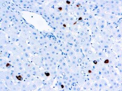Immunohistochemistry-Paraffin: HBsAg Antibody (3E7) [NBP1-22568] - Formalin fixed paraffin embedded infected liver stained with HBsAg antibody (NBP1-22568).