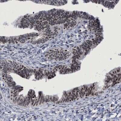 Immunohistochemistry: HCA59 Antibody [NBP1-83168] - Staining of human Fallopian tube shows moderate nuclear positivity in glandular cells.