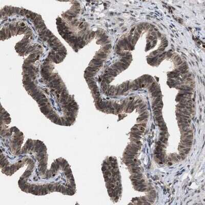 Immunohistochemistry: HCA59 Antibody [NBP1-83170] - Staining of human Fallopian tube shows moderate nuclear positivity in glandular cells.