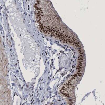 Immunohistochemistry-Paraffin: HCA59 Antibody [NBP1-83168] - Staining of human gall bladder shows strong nuclear positivity in glandular cells.