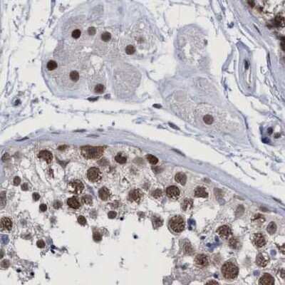 Immunohistochemistry-Paraffin: HCA59 Antibody [NBP1-83168] - Staining of human testis.
