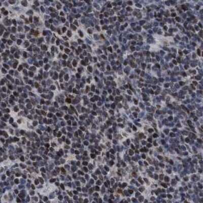 Immunohistochemistry-Paraffin: HCA59 Antibody [NBP1-83168] - Staining of human lymph node.