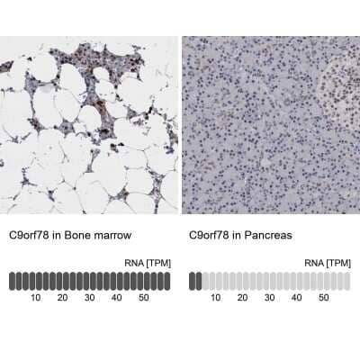 Immunohistochemistry-Paraffin: HCA59 Antibody [NBP1-83168] - Analysis in human bone marrow and pancreas tissues. Corresponding HCA59 RNA-seq data are presented for the same tissues.