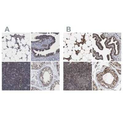Immunohistochemistry-Paraffin: HCA59 Antibody [NBP1-83168] - Staining of human bone marrow, fallopian tube, lymph node and testis using Anti-HCA59 antibody NBP1-83168 (A) shows similar protein distribution across tissues to independent antibody NBP1-83170 (B).
