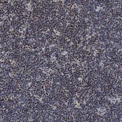 Immunohistochemistry-Paraffin: HCA59 Antibody [NBP1-83168] - Staining of human lymph node shows strong nuclear positivity in non-germinal center cells.