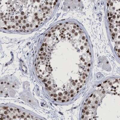 Immunohistochemistry-Paraffin: HCA59 Antibody [NBP1-83168] - Staining of human testis shows strong nuclear positivity in cells in seminiferous ducts.