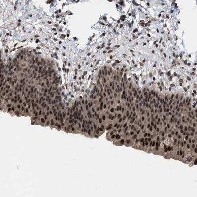 Immunohistochemistry-Paraffin: HCA59 Antibody [NBP1-83170] - Staining of human urinary bladder shows strong nuclear positivity in urothelial cells.