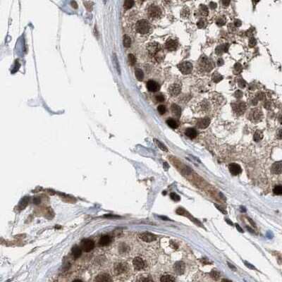 Immunohistochemistry-Paraffin: HCA59 Antibody [NBP1-83170] - Staining of human testis.