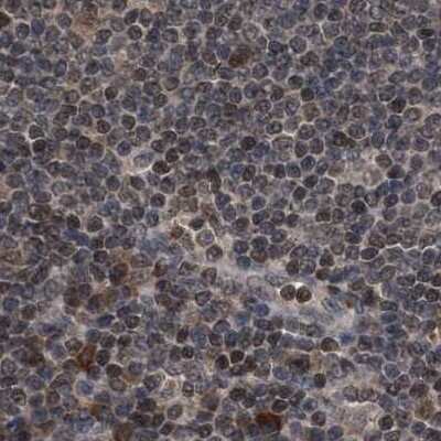 Immunohistochemistry-Paraffin: HCA59 Antibody [NBP1-83170] - Staining of human lymph node.
