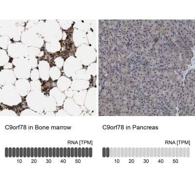<b>Orthogonal Strategies Validation. </b>Immunohistochemistry-Paraffin: HCA59 Antibody [NBP1-83170] - Analysis in human bone marrow and pancreas tissues. Corresponding HCA59 RNA-seq data are presented for the same tissues.