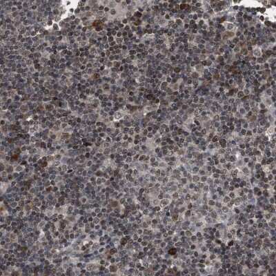 Immunohistochemistry-Paraffin: HCA59 Antibody [NBP1-83170] - Staining of human lymph node shows strong nuclear positivity in non-germinal center cells.