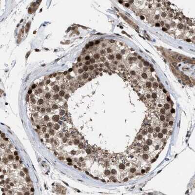 Immunohistochemistry-Paraffin: HCA59 Antibody [NBP1-83170] - Staining of human testis shows strong nuclear positivity in cells in seminiferous ducts.